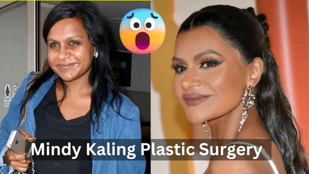 mindy kaling plastic surgery