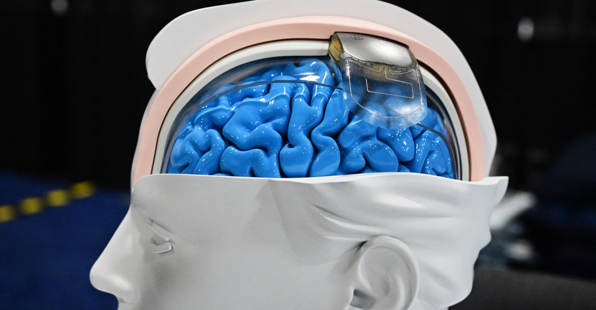 Revolusi Teknologi Otak ada di sini � dan tidak semua cermin hitam